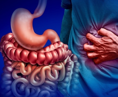 Biến chứng nào xảy ra nếu bệnh Crohn không được điều trị kịp thời
